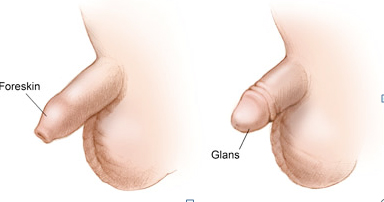 欽州桂大醫(yī)院治療包皮過長怎么樣